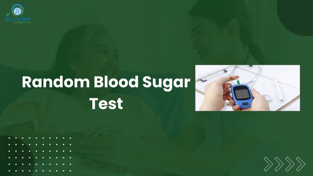 Random Blood Sugar Test