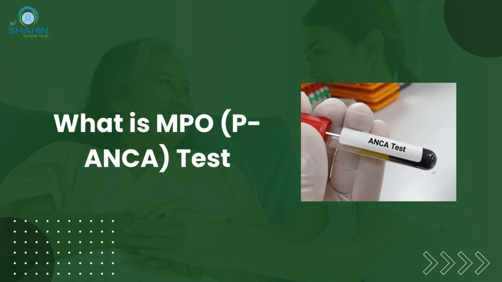 What is MPO (P-ANCA) Test