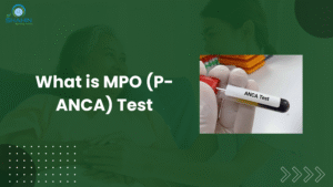 What is MPO (P-ANCA) Test